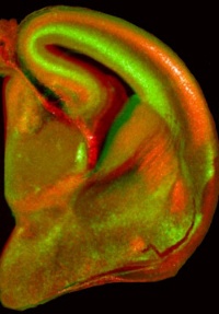 Secció d'un cervell embrionari. FOTO: UdL - Universitat de Lleida