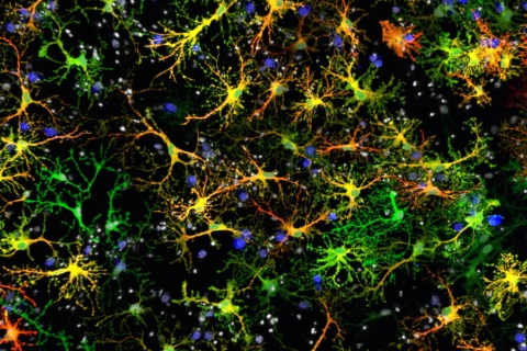 neurones rata_Kevin Richetin