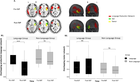 neuroplasticitat
