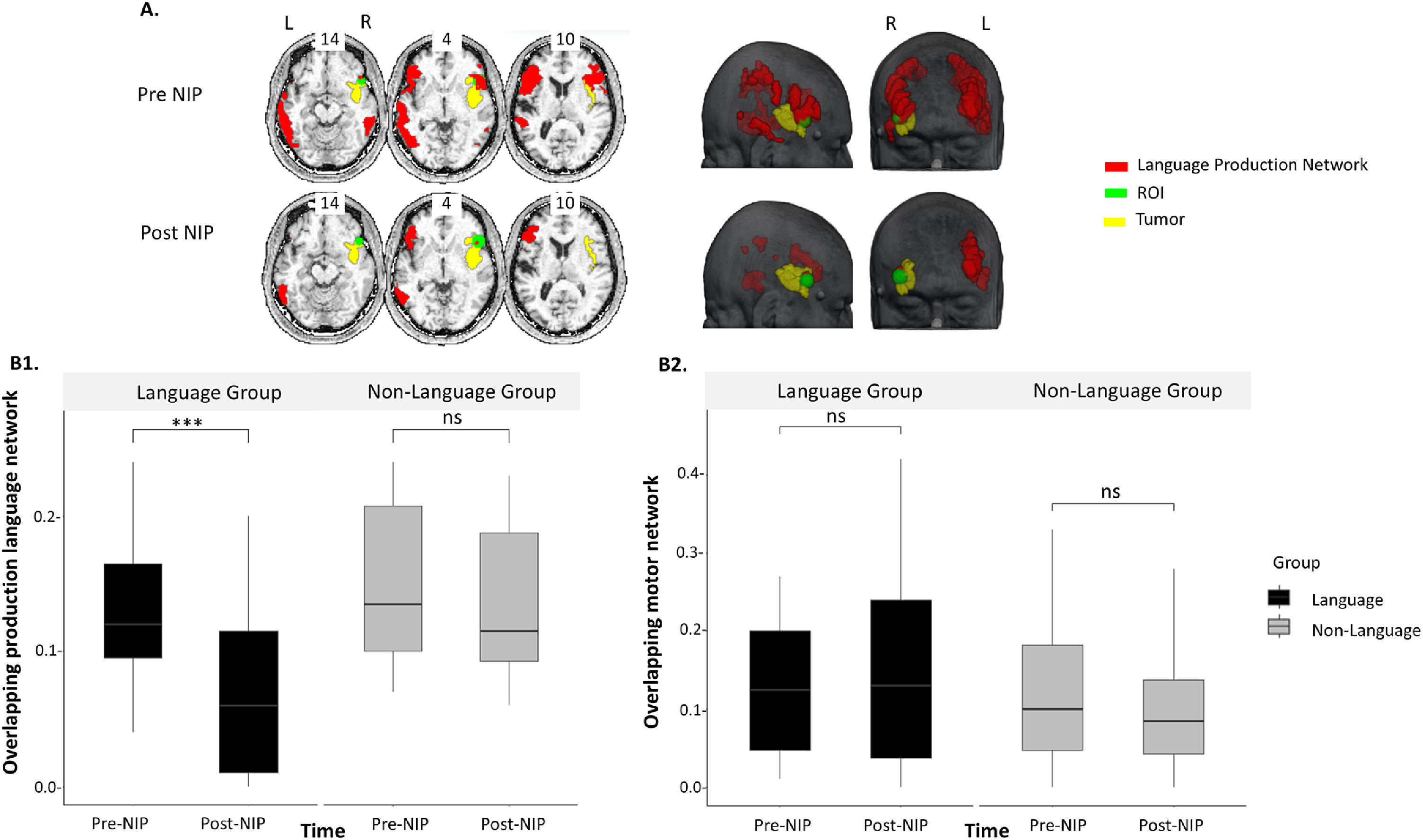neuroplasticitat