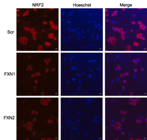 recerca ataxia